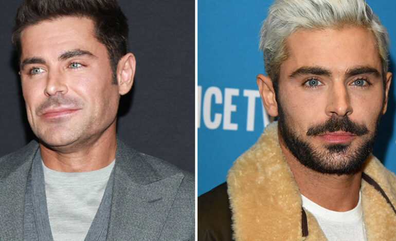 Zac Efron Jaw Accident: What Really Happened?